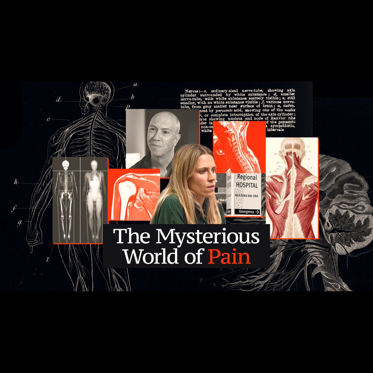 The Mysterious World of Pain